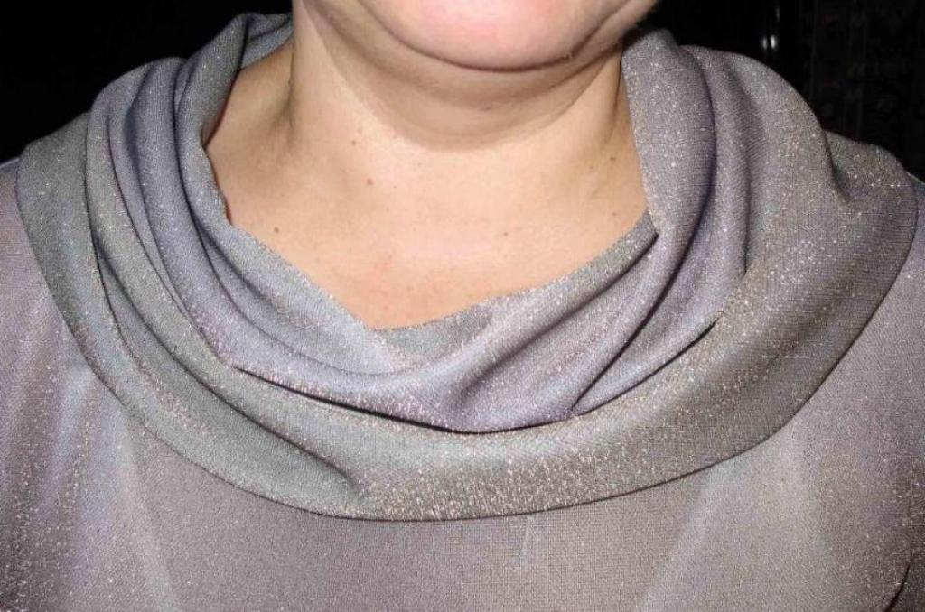 Вариации на тему воротника