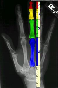 post-13308-1337108419_thumb.jpg