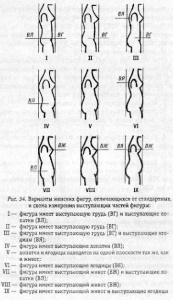 post-348-1528689359_thumb.jpg