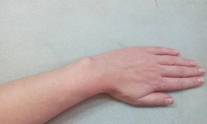 post-918-1466360470_thumb.jpg